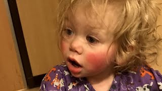 Meet 1YearOld Who’s Allergic to Tears [upl. by Nodyarb]