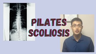 Pilates Workout for Scoliosis [upl. by Diao]