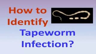 How to identify tapeworm infection [upl. by Marinna970]