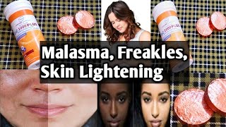 CaC100Plus Calcium Tablets for Freckles  Malasma  Skin Lightening [upl. by Umeh]