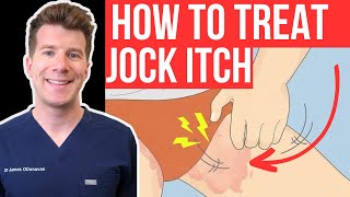 Doctor explains how to RECOGNISE AND TREAT JOCK ITCH aka Tinea Cruris or Ringworm of the groin [upl. by Asante]