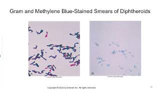 Aerobic Gram Positive Bacilli [upl. by Brooks]