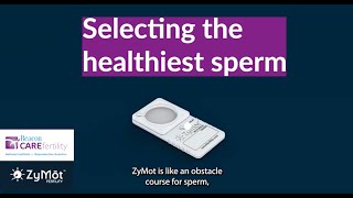 Sperm Selection Technology at Beacon CARE Fertility ZyMot [upl. by Enelyw251]