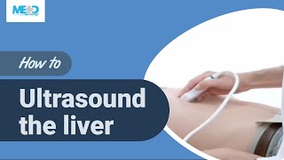 How to ultrasound the liver [upl. by Akema]