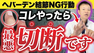 【指がこうなった人は気をつけて】知らないと後悔する「ヘバーデン結節」の危険サインとは？（ばね指・リウマチ） [upl. by Frentz]