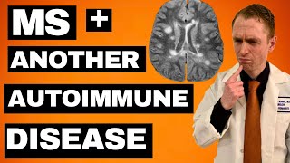 MS  Another Autoimmune Disease Treatment Options [upl. by Hermia]