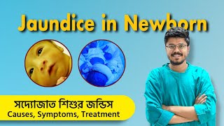 সদ্যোজাত শিশুর জন্ডিস কারণ লক্ষণ চিকিৎসা  Newborn Jaundice Causes Symptoms Treatment [upl. by Hachmin390]