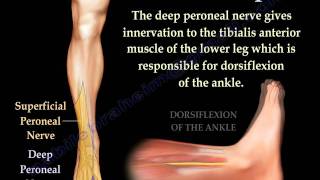 Foot Drop Peroneal Nerve Injury  Everything You Need To Know  Dr Nabil Ebraheim [upl. by Ardelia]