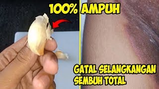 100 Ampuh  Gatal SELANK KHANGAN Sembuh total bro [upl. by Gellman593]