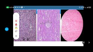 Histology Slides Series Episode 13  Histology of the Urinary System [upl. by Isabelita]