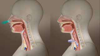 Tracheotomy Care What Is A Tracheotomy [upl. by Sussi]