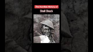 The Shocking History of “Shell Shock” [upl. by Enaywd]