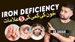 5 Symptoms of Iron Deficiency  Khoon Ki Kami [upl. by Anairda]