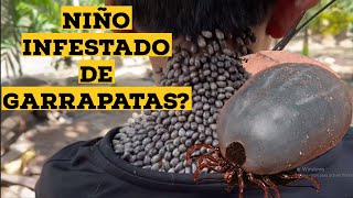 Niño con Garrapatas en la Espalda ¿Falso o Verdadero Analisis [upl. by Asus]