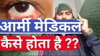 Eyes medical test army  indian Army test eyes medical [upl. by Boelter]