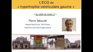 7c Hypertrophie ventriculaire gauche Au delà du basic partie 2 ECG Dr Taboulet [upl. by Vlada565]