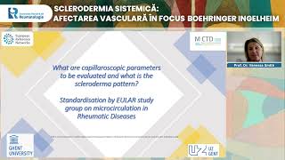 Webinar  Sclerodermia sistemica afectarea vasculara in focus 29 iunie 2022 [upl. by Einnahc892]