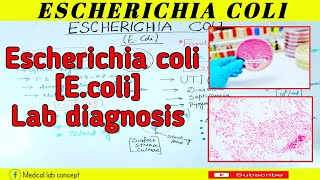 Escherichia coliEcoliLab diagnosisMedical Lab Concept [upl. by Ennairrac]