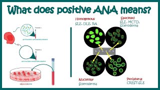 Antinuclear Antibodies ANA test and their patterns  ANA test  What does ANA test positive mean [upl. by Segroeg311]