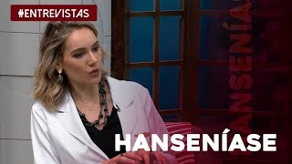 Tudo o que você precisa saber sobre a hanseníase [upl. by Yemiaj]