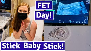 Frozen Embryo Transfer Day FET Process [upl. by Xenia]