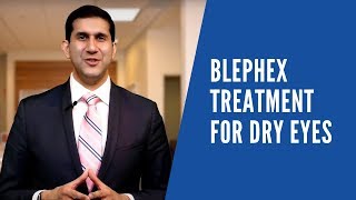 BlephEx Treatment for Dry Eyes [upl. by Bron]