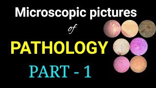 Microscopic pictures of pathology I Dr Poojireddy [upl. by Didier308]