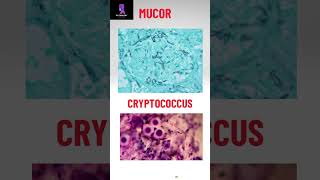 Morphology of some pathogenic fungi pathologyacademy mbbs draditikumar labtechnician [upl. by Nwahsyar]