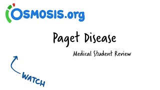 Paget Disease Osmosis Study Video [upl. by Aiciles]