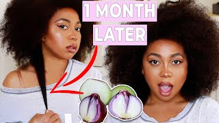 ONION JUICE FOR EXTREME HAIR GROWTH HOW YOU CAN USE ONION JUICE FOR MASSIVE HAIR GROWTH UPDATE [upl. by Haelam]