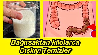 Bir gecede 3 kilo verdiriyor kolon temizliği bağırsak kıvrımlarını temizler [upl. by Nort]