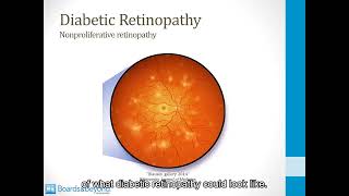 CNS 53 The Retina [upl. by Nwahc639]