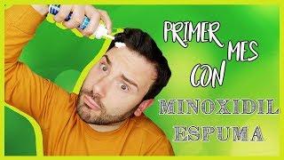 Primer mes con MINOXIDIL ESPUMA  ¿Funciona [upl. by Leasia]