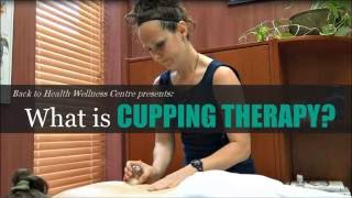 What is Cupping How Does Cupping Therapy Work  Back to Health Wellness Centre [upl. by Soll]