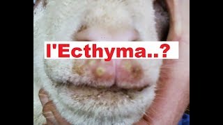 lEcthyma contagieux [upl. by Efi]