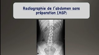 Radiologie  1er cours  ASP 1ère partie [upl. by Akli]