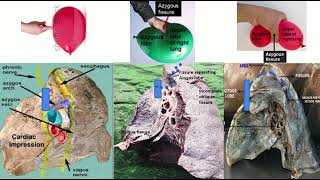 Azygos Vein amp Fissure on Radiology Xray CT amp MRI [upl. by Harwill996]