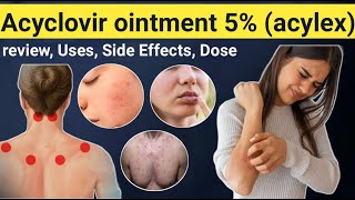 Acyclovir Ointment Uses  Review Acylex ointment uses Side effects contraindications [upl. by Adiaj]