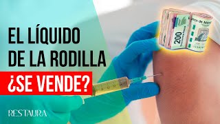 El líquido de la rodilla ¿Se vende ¿A cuánto [upl. by Akim866]