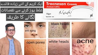 Tracnesan tretinoin cream reviewhow to apply tretinoin creamtretinoin cream skin benefits [upl. by Lietman]