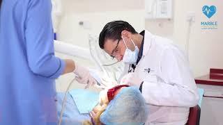 تنظيف و تلميع الأسنان باستخدام تقنية بروفي جيت Prophyjet Teeth cleaning and polishing [upl. by Ardella]