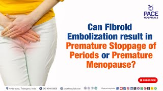 Can Fibroid Embolization result in Premature Stoppage of Periods or Premature Menopause [upl. by Kumler]