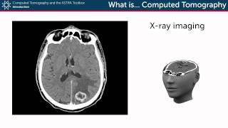 What is Computed Tomography [upl. by Nappy]