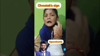 Chvosteks sign hypocalcemia nurses medical pediatrics students prometric [upl. by Prouty]