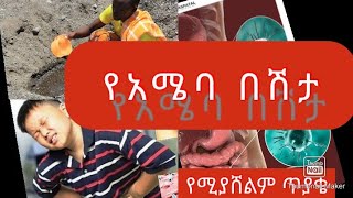 የአሜባ በሽታAmoebiasis 🦠Amoebic Dysentery Lecturing Video Causes Sign and symptomRxDx amp prevention [upl. by Atinit714]