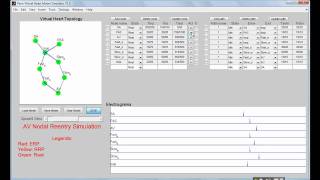 VHM Virtual heart model AVNRT simulation [upl. by Edya]