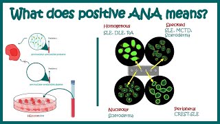 ANA test positive means   Antinuclear Antibody Test ANA procedure wellnessbuddy [upl. by Laenahtan904]