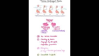 TracheoEsophageal fistula [upl. by Neladgam]