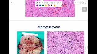 MSS pathology lab 1  part 4 [upl. by Ireva]