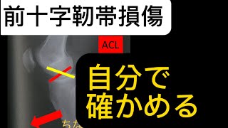 前十字靭帯損傷の検査である前方引き出しテストを解説しました [upl. by Yeorgi]